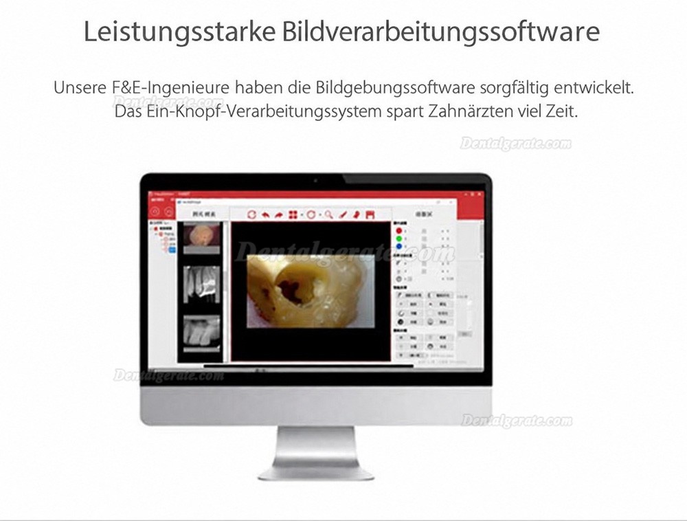 Handy HDR-600A Digitaler Intraorale R&ouml;ntgensensor Zahn&auml;rztlich Intraorale Flachkollektoren